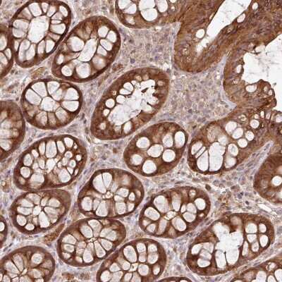 Immunohistochemistry: FAIM1 Antibody [NBP2-47463] - Staining of human rectum shows strong cytoplasmic positivity in glandular cells.