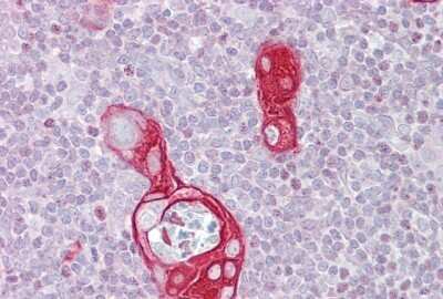 Immunohistochemistry-Paraffin: FAIM1 Antibody [NBP1-55209] - Human thymus tissue at an antibody concentration of 5ug/ml.