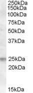 Western Blot: FAIM1 Antibody [NB100-77331] - Analysis of FAIM1 using NB100-77331 at 0.5ug/ml in Human Lymph Node lysate (35ug protein in RIPA buffer). Primary incubation was 1 hour. Detected by chemiluminescence.