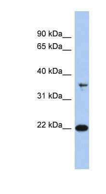 Western Blot: FAIM1 Antibody [NBP1-55209] - Jurkat cell lysate, Antibody Titration: 0.2-1 ug/ml