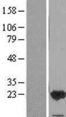 Western Blot: FAIM1 Overexpression Lysate (Adult Normal) [NBP2-11214] Left-Empty vector transfected control cell lysate (HEK293 cell lysate); Right -Over-expression Lysate for FAIM1.