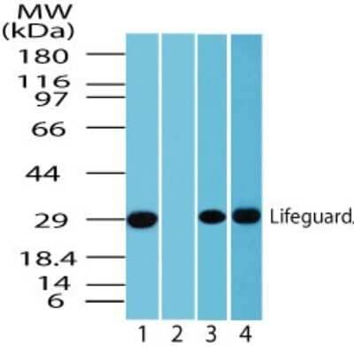 Western Blot: FAIM2 Antibody - Azide Free [NBP2-33257] - analysis of human Lifeguard in human brain lysate in the 1) absence and 2) presence of immunizing peptide using this antibody. 5 ug/ml. Image from the standard format of this antibody.