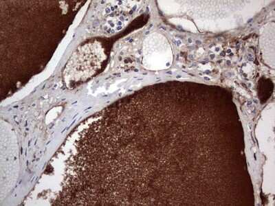 Immunohistochemistry: FAIM3 Antibody (1E6) [NBP2-45575] - Analysis of Human thyroid tissue. (Heat-induced epitope retrieval by 1 mM EDTA in 10mM Tris, pH8.5, 120C for 3min)