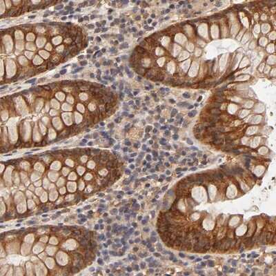 Immunohistochemistry-Paraffin: FAIM3 Antibody [NBP1-86924] - Staining of human colon shows strong cytoplasmic positivity in glandular cells.