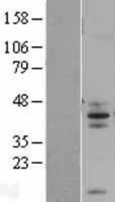 Western Blot FAIM3 Overexpression Lysate