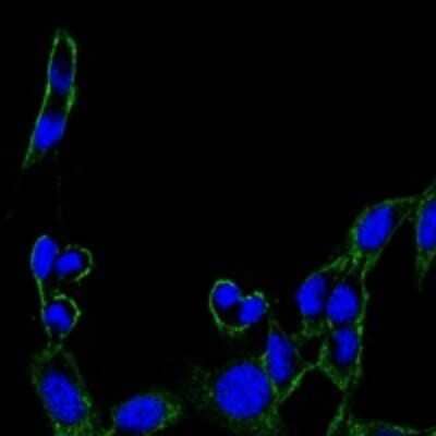 Immunocytochemistry/Immunofluorescence: FAK Antibody (10H7) [NBP2-22168] - Immunofluorescence analysis of B16 cells using FAK mouse mAb (green). Blue: DRAQ5 fluorescent DNA dye.