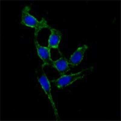 Immunocytochemistry/Immunofluorescence: FAK Antibody (10H7E9) [NBP1-47494] - Analysis of A549 cells using FAK mouse mAb (green). Blue: DRAQ5 fluorescent DNA dye.
