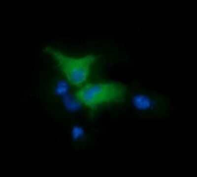 Immunocytochemistry/Immunofluorescence: FAK Antibody (OTI4D11) - Azide and BSA Free [NBP2-71268] - Analysis  of COS7 cells transiently transfected by pCMV6-ENTRY FAK.