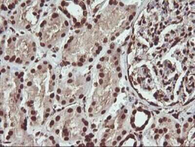 Immunohistochemistry: FAK Antibody (OTI4D11) - Azide and BSA Free [NBP2-71268] - Analysis of Human Kidney tissue. (Heat-induced epitope retrieval by 10mM citric buffer, pH6.0, 120C for 3min)