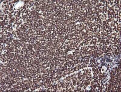 Immunohistochemistry: FAK Antibody (OTI4D11) - Azide and BSA Free [NBP2-71268] - Analysis of Human tonsil tissue. (Heat-induced epitope retrieval by 10mM citric buffer, pH6.0, 120C for 3min)