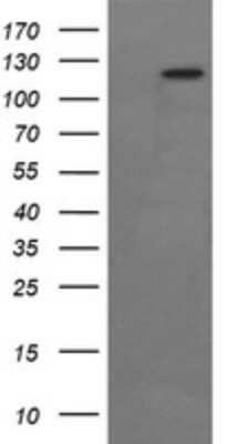 Western Blot: FAK Antibody (OTI4D11) - Azide and BSA Free [NBP2-71268] - Analysis of HEK293T cells were transfected with the pCMV6-ENTRY control (Left lane) or pCMV6-ENTRY FAK .