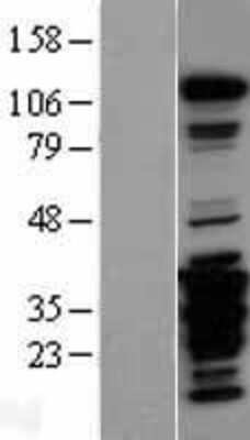 Western Blot FAK Overexpression Lysate