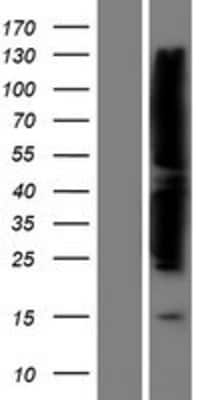 Western Blot FAK Overexpression Lysate