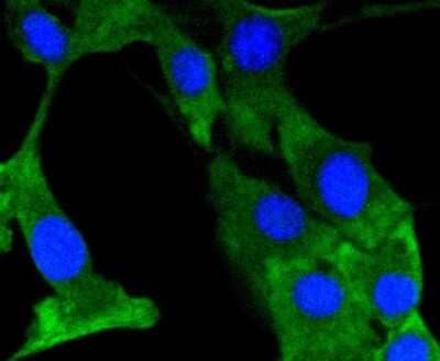Immunocytochemistry/Immunofluorescence: FAK [p Tyr397] Antibody (SC54-07) [NBP2-67577] - Staining phospho-FAK (Y397) in NIH/3T3 cells (green). The nuclear counter stain is DAPI (blue). Cells were fixed in paraformaldehyde, permeabilised with 0.25% Triton X100/PBS.