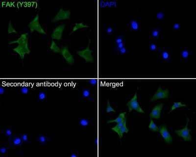 Immunocytochemistry/Immunofluorescence: FAK [p Tyr397] Antibody (SC54-07) [NBP2-67577] - Analysis of NIH/3T3 cells labeling Phospho-FAK (Y397) with Rabbit anti-Phospho-FAK (Y397) antibody (permeabilized with 0.05% Triton X-100 in PBS for 20 minutes, and then blocked with 2% negative goat serum for 30 minutes at room temperature. Cells were then incubated with Rabbit anti-Phospho-FAK (Y397) antibody  was used as the secondary antibody at 1/1,000 dilution. PBS instead of the primary antibody was used as the secondary antibody only control. Nuclear DNA was labelled in blue with DAPI.