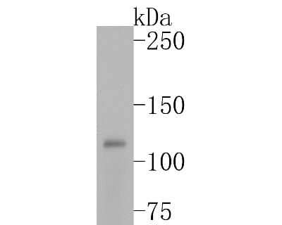 Western Blot: FAK [p Tyr397] Antibody (SC54-07) [NBP2-67577] - Western blot analysis of FAK on K562 cell lysates. Proteins were transferred to a PVDF membrane and blocked with 5% BSA in PBS for 1 hour at room temperature. The primary antibody (1/500) was used in 5% BSA at room temperature for 2 hours. Goat Anti-Rabbi