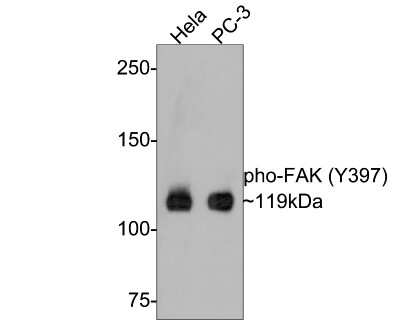Western Blot: FAK [p Tyr397] Antibody (SC54-07) [NBP2-67577] - Analysis of FAK [p Tyr397] on different lysates with Rabbit anti-FAK [p Tyr397]  antibody at 1/500 dilution. Lane 1: Hela cell lysate Lane 2: PC-3 cell lysate Lysates/proteins at 10 ug/Lane. Predicted band size: 119 kDa Observed band size: 119 kDa Exposure time: 2 minutes; 6% SDS-PAGE gel. Proteins were transferred to a PVDF membrane and blocked with 5% NFDM/TBST for 1 hour at room temperature. The primary antibody at 1/500 dilution was used in 5% NFDM/TBST at room temperature for 2 hours. Goat Anti-Rabbit IgG - HRP Secondary Antibody at 1:300,000 dilution was used for 1 hour at room temperature.