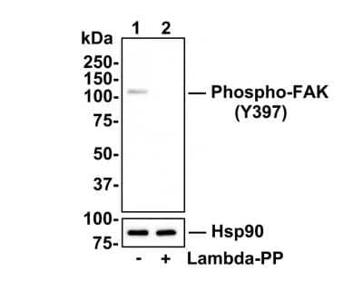 Western Blot: FAK [p Tyr397] Antibody (SC54-07) [NBP2-67577] - Analysis of FAK [p Try397] on Hela cell lysates. Lane 1: Hela cells, whole cell lysate, 10ug/lane Lane 2: Hela cells treated with 2.8ug/ul lambda-PP for 30 minutes, whole cell lysates, 10ug/lane All lanes : Anti-FAK [p Try397] antibody at 1:500 dilution. Anti-Hsp90 antibody at 1:10,000 dilution. Goat Anti-Rabbit IgG H&L (HRP) at 1/200,000 dilution. Predicted band size: 119 kDa Observed band size: 119 kDa Blocking and diluting buffer: 5% BSA. Exposure time: 30 seconds