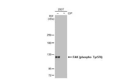 <b>Biological Strategies Validation. </b>Western Blot: FAK [p Tyr576] Antibody (HL127) [NBP3-13675] - HepG2 whole cell extracts (30 ug) were separated by 5% SDS-PAGE, and the membrane was blotted with FAK (phospho Tyr576) antibody [HL127] (NBP3-13675) diluted at 1:500. The HRP-conjugated anti-rabbit IgG antibody (NBP2-19301) was used to detect the primary antibody.