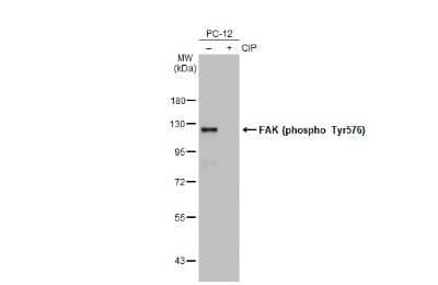 Western Blot: FAK [p Tyr576] Antibody (HL127) [NBP3-13675] - Untreated (-) and treated (+) PC-12 whole cell extracts (30 ug) were separated by 7.5% SDS-PAGE, and the membrane was blotted with FAK (phospho Tyr576) antibody [HL127] (NBP3-13675) diluted at 1:500. The HRP-conjugated anti-rabbit IgG antibody (NBP2-19301) was used to detect the primary antibody.