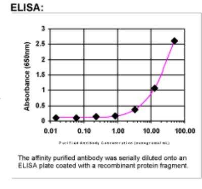 ELISA: FALDH Antibody [31170002]