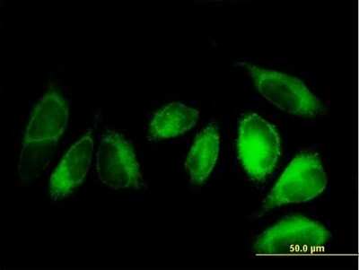 Immunocytochemistry/Immunofluorescence: FALDH Antibody [H00000224-B01P] - Analysis of purified antibody to ALDH3A2 on HeLa cell. (antibody concentration 10 ug/ml)