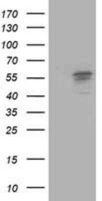 Western Blot: FALDH Antibody (OTI2A7) - Azide and BSA Free [NBP2-70159] - HEK293T cells were transfected with the pCMV6-ENTRY control (Left lane) or pCMV6-ENTRY FALDH (Right lane) cDNA for 48 hrs and lysed. Equivalent amounts of cell lysates (5 ug per lane) were separated by SDS-PAGE and immunoblotted with anti-FALDH.