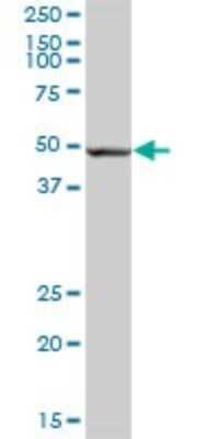Western Blot: FALDH Antibody [H00000224-B01P] - Analysis of ALDH3A2 expression in human liver.