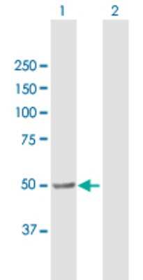 Western Blot: FALDH Antibody [H00000224-B01P] - Analysis of ALDH3A2 expression in transfected 293T cell line by ALDH3A2 polyclonal antibody.  Lane 1: ALDH3A2 transfected lysate(55.88 KDa). Lane 2: Non-transfected lysate.
