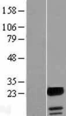 Western Blot: FAM100A Overexpression Lysate (Adult Normal) [NBL1-10434] Left-Empty vector transfected control cell lysate (HEK293 cell lysate); Right -Over-expression Lysate for FAM100A.