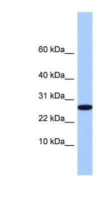Western Blot: FAM101A Antibody [NBP1-79528] - 721_B cell lysate.