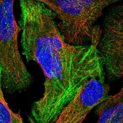 Immunocytochemistry/Immunofluorescence: FAM101B Antibody [NBP2-30519] - Immunofluorescent staining of human cell line U-2 OS shows localization to cytosol & actin filaments.