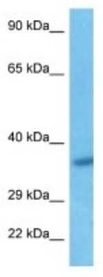 Western Blot: FAM102A Antibody [NBP3-10723] - Western blot analysis of FAM102A in Hela Whole Cell. Antibody dilution at 1.0ug/ml