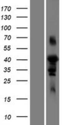 Western Blot: FAM102A Overexpression Lysate (Adult Normal) [NBP2-08585] Left-Empty vector transfected control cell lysate (HEK293 cell lysate); Right -Over-expression Lysate for FAM102A.