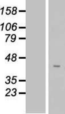 Western Blot FAM102B Overexpression Lysate
