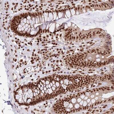 Immunohistochemistry-Paraffin: FAM103A1 Antibody [NBP1-88435] - Staining of human colon shows strong nuclear positivity in glandular cells.