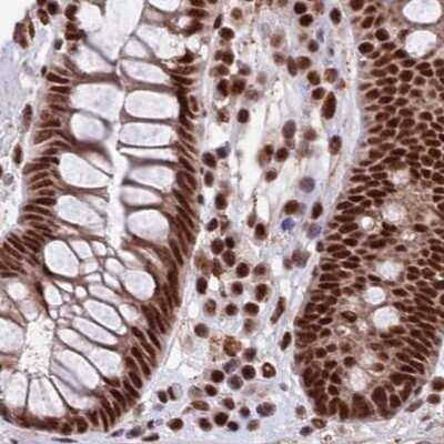 Immunohistochemistry-Paraffin: FAM103A1 Antibody [NBP1-88435] - Staining of human colon.