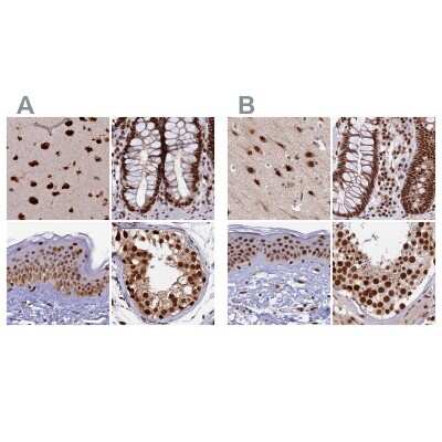 Immunohistochemistry-Paraffin: FAM103A1 Antibody [NBP1-88436] - Staining of human cerebral cortex, colon, skin and testis using Anti-FAM103A1 antibody NBP1-88436 (A) shows similar protein distribution across tissues to independent antibody NBP1-88435 (B).