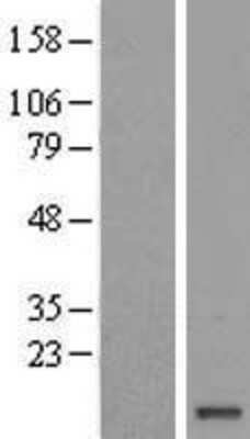 Western Blot: FAM103A1 Overexpression Lysate (Adult Normal) [NBL1-10435] Left-Empty vector transfected control cell lysate (HEK293 cell lysate); Right -Over-expression Lysate for FAM103A1.