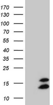 Western Blot: FAM104B Antibody (OTI1D10) - Azide and BSA Free [NBP2-72313] - Analysis of HEK293T cells were transfected with the pCMV6-ENTRY control (Left lane) or pCMV6-ENTRY FAM104B.
