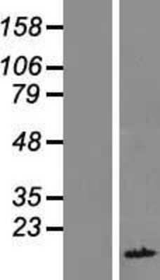 Western Blot: FAM104B Overexpression Lysate (Adult Normal) [NBL1-10436] Left-Empty vector transfected control cell lysate (HEK293 cell lysate); Right -Over-expression Lysate for FAM104B.