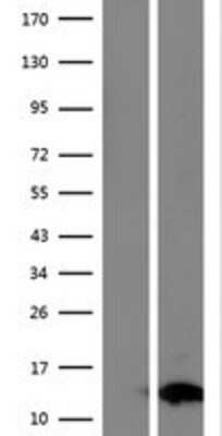 Western Blot: FAM104B Overexpression Lysate (Adult Normal) [NBP2-10242] Left-Empty vector transfected control cell lysate (HEK293 cell lysate); Right -Over-expression Lysate for FAM104B.