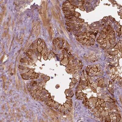 Immunohistochemistry FAM107B Antibody