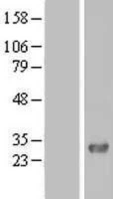 Western Blot: FAM109A Overexpression Lysate (Adult Normal) [NBL1-10441] Left-Empty vector transfected control cell lysate (HEK293 cell lysate); Right -Over-expression Lysate for FAM109A.