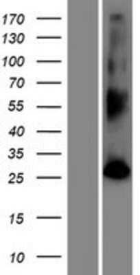 Western Blot: FAM109B Overexpression Lysate (Adult Normal) [NBP2-08946] Left-Empty vector transfected control cell lysate (HEK293 cell lysate); Right -Over-expression Lysate for FAM109B.