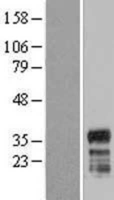 Western Blot: FAM110A Overexpression Lysate (Adult Normal) [NBP2-06129] Left-Empty vector transfected control cell lysate (HEK293 cell lysate); Right -Over-expression Lysate for FAM110A.