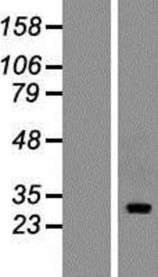 Western Blot: FAM110A Overexpression Lysate (Adult Normal) [NBP2-09225] Left-Empty vector transfected control cell lysate (HEK293 cell lysate); Right -Over-expression Lysate for FAM110A.