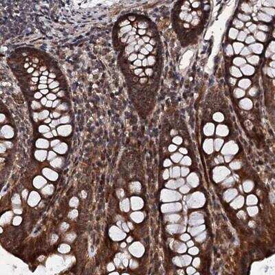 Immunohistochemistry-Paraffin FAM111A Antibody - BSA Free