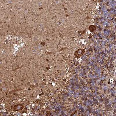 Immunohistochemistry-Paraffin: FAM113A Antibody [NBP2-13976] - Staining of human cerebellum shows strong cytoplasmic positivity in Purkinje cells.