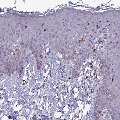 Immunohistochemistry-Paraffin: FAM113B Antibody [NBP1-91879] - Staining of human skin shows distinct cytoplasmic positivity in Langerhans cells.